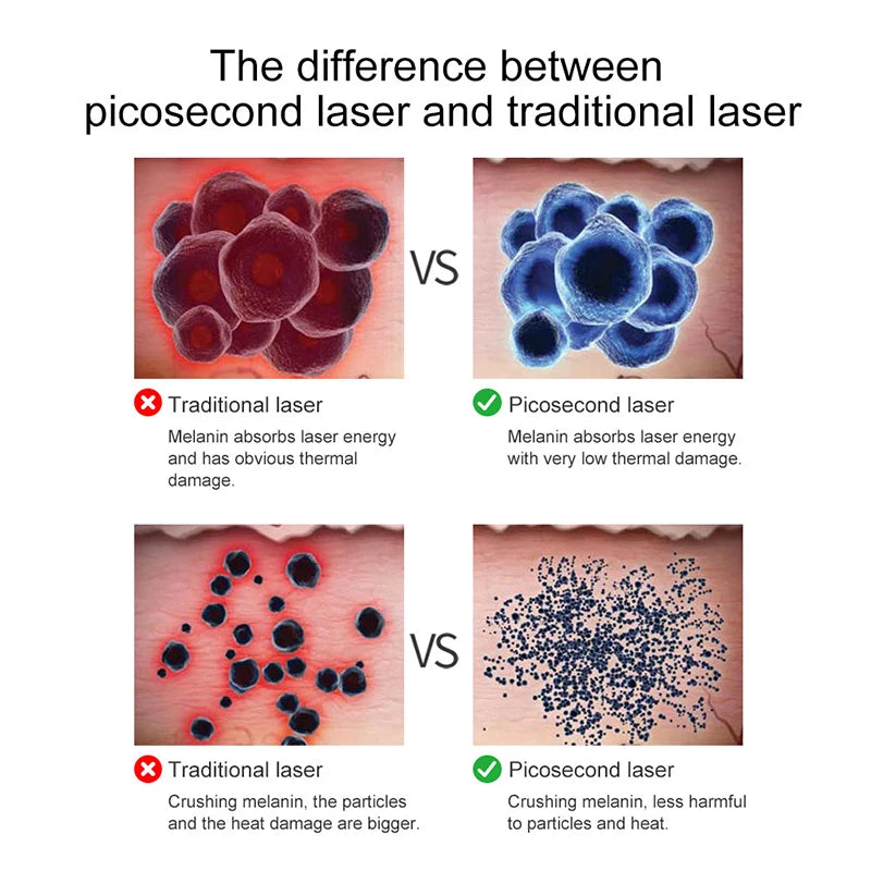 Filter Laser (scar removal laser)