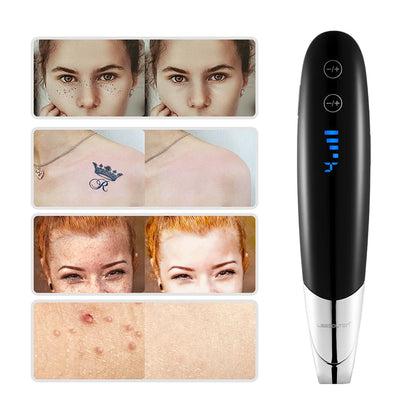 Filter Laser (scar removal laser)