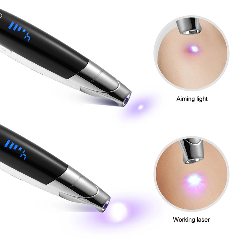 Filter Laser (scar removal laser)
